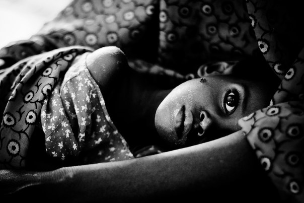 Маленькая, ослабленная болезнями девочка лежит на коленях у своей матери в больнице лагеря для беженцев Дадааб.