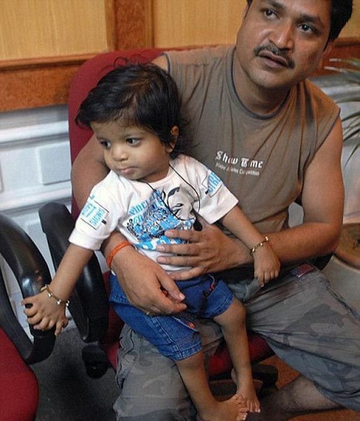 Необычный мальчик по имени Акшат Саксена живет в Индии. У него 34 пальца на руках и на ногах.