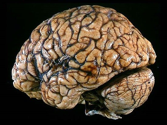 Количество извилин в мозгу никак не связано с наличием ума.