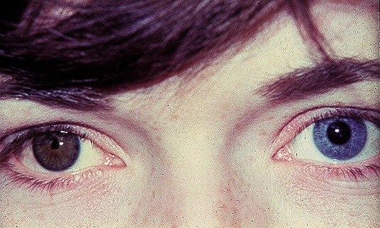 На Земле около 1% людей с глазами разного цвета.