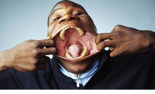 Самый большой рот в мире у француза Доминго Жоакима.
