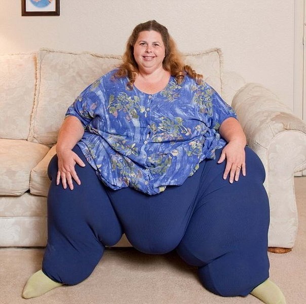 Самая толстая в мире женщина Полин Поттер винит гены в своем весе 315кг