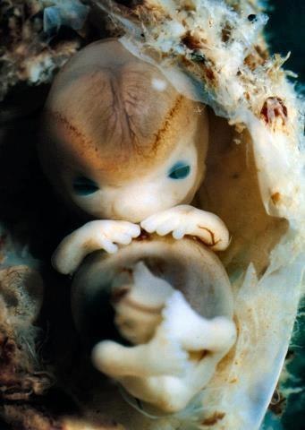 Эмбрион человека, 7 недель, размер 14 мм