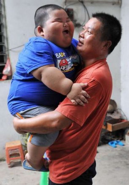 Самый толстый ребенок в мире живет в Китае 