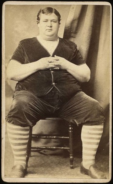 Сто лет назад этот мужчина считался настолько толстым, что его показывали в цирке.