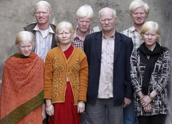 Индийская семья Пуллан признана самой большой семьей альбиносов в мире 