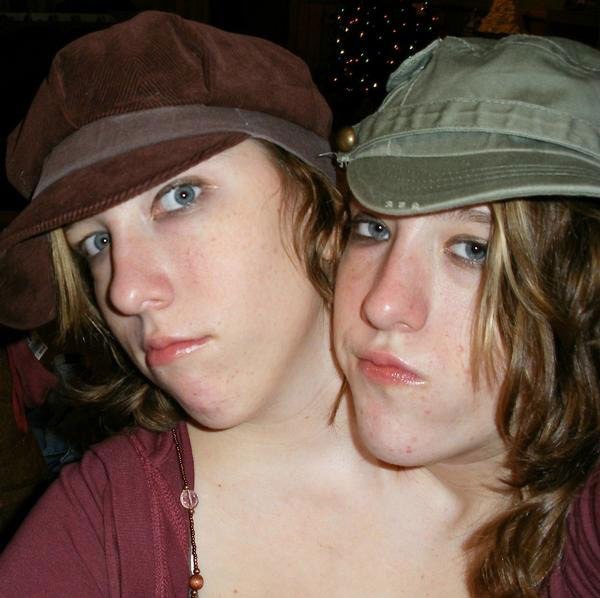 Сросшиеся близнецы – Эбигейл и Бриттани Хенсел, 1990 года рождения, проживающие в США. 