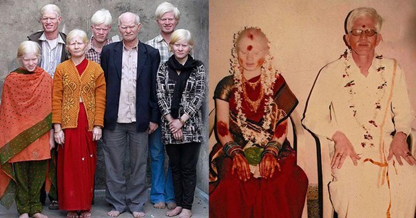 Самая большая семья альбиносов.