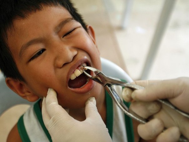 Мальчику удаляют зуб в ходе рекордного стоматологического обследования в трущобах Манилы. Здесь был установлен рекорд по наибольшему количеству обслуженных пациентов за 24 часа.