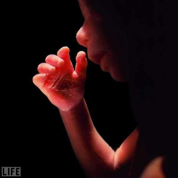 Первый в истории снимок ребенка в утробе матери, 1965. Автор - Lennart Nilsson.