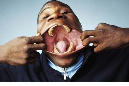 Самый большой рот в мире у француза Доминго Жоакима.