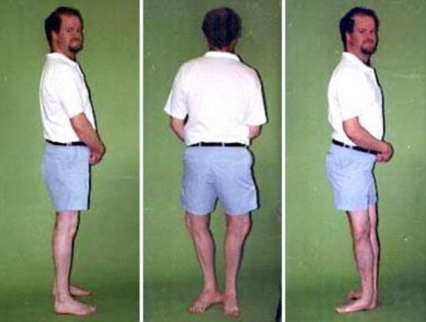 Мозес Ланхем признан самым гибким человеком в мире
