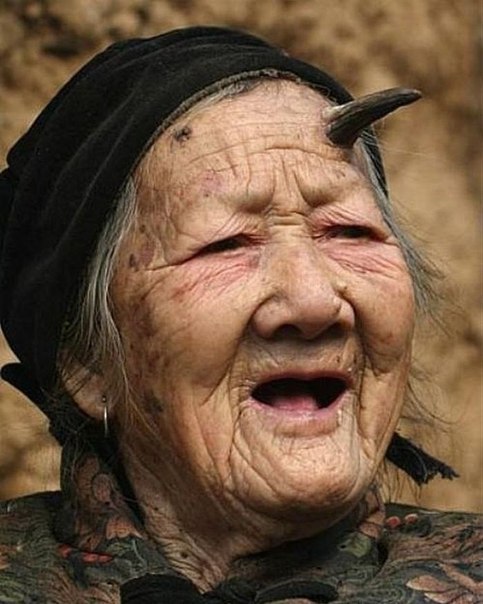101-летняя китаянка Чжан Руфанг (Zhang Ruifang) с недавних пор стала достопримечательностью деревеньки Линлоу, что в провинции Хэнань. Год назад у бабули на лбу над левым глазом вырос настоящий дьявольский рог! А теперь растет и второй – над правым.