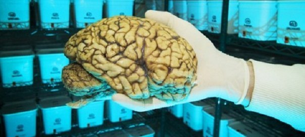 Самый большой банк мозгов в мире находится в Гарварде, в больнице Маклина в Белмонте, штат Массачусетс.