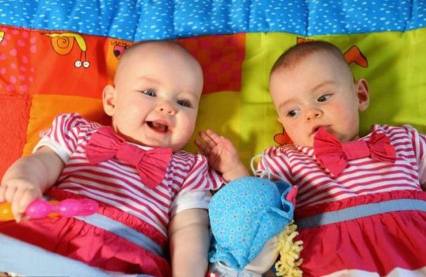 В Ирландии родились близнецы с разницей в 87 дней