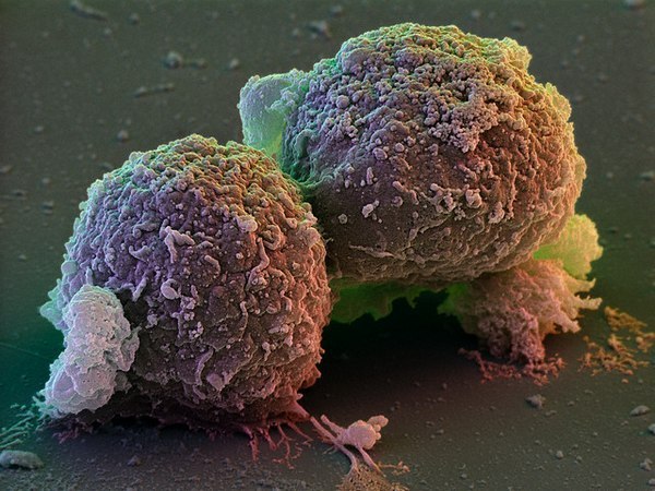 Обнаружен «белок бессмертия» в стволовых клетках