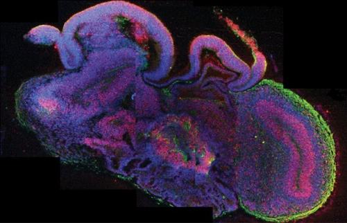 Ученые вырастили миниатюрный человеческий мозг в пробирке