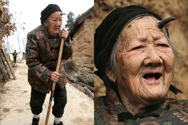 У 101-летней китаянки во лбу вырос рог...