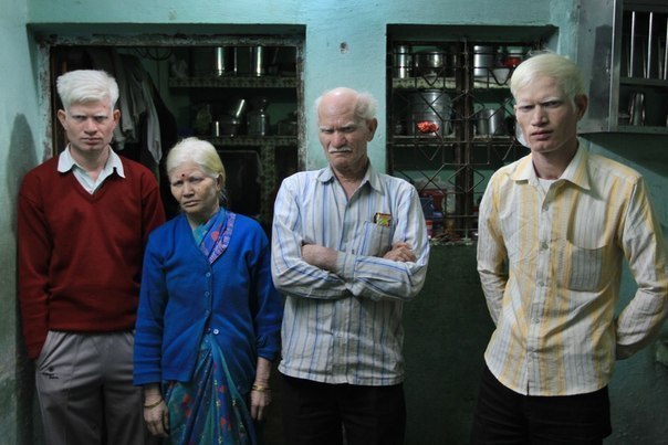 Индийская семья, которая претендует на место в Книге рекордов Гиннесса как самая многочисленная семья альбиносов. У 50-летнего Росетаури и 45-летней Мани Пулан — шесть детей, а также два близких родственника с альбинизмом.