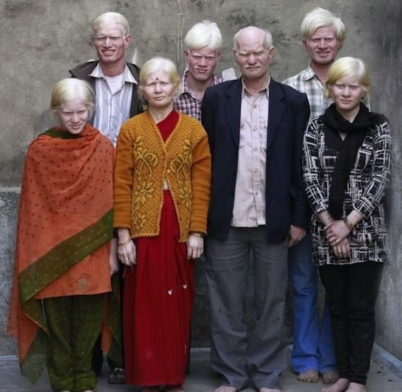 Самая большая семья альбиносов в мире проживает в Индии. Отец семейства Розитурай Пуллан, его жена Мани и шесть их детей все являются чистейшими альбиносами.