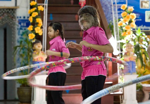 11-летняя Супатра Сасупфан из пригорода Бангкока попала в Книгу рекордов Гиннесса как самая волосатая девочка в мире. Все лицо, уши, руки, ноги и спина малышки покрыты густой «шерстью», что делает ее похожей на волка. Интересно, что сама девочка уже свыклась со своей особенностью и даже гордится тем, что стала такой популярной.