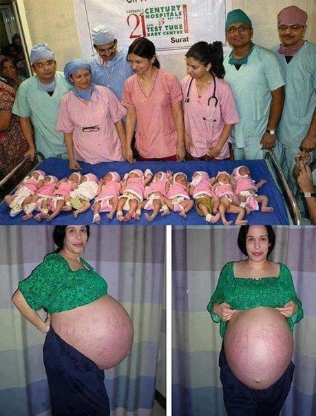Индийская женщина родила 11 детей!!!! :)