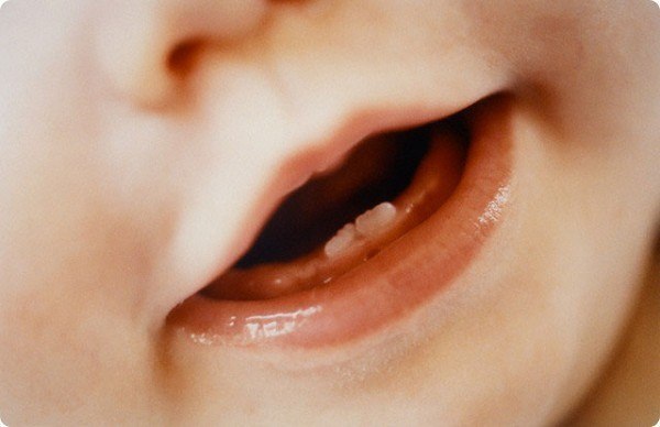 Уникальный ребенок родился на днях в Англии. Там, 26-летняя Вики Гриффит родила девочку, у которой уже имелись во рту зубки. У малышки, которую назвали Евой, врачи обнаружили 2 натальных зубика.