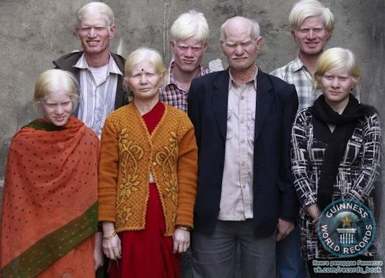 Самая большая в мире семья альбиносов насчитывает 10 человек