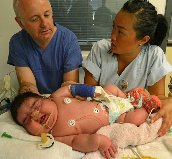 В немецком городе Лейпциг родилась девочка весом 6100 грамм! Рост у Яслин (Jasleen), которой всего 5 дней отроду, равен 57,5 см. Она вошла в историю как самая крупная новорожденная в мире.