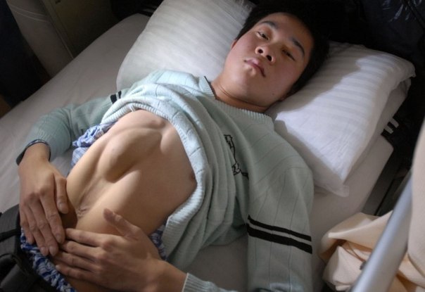 24-летний Хуанг Ронгминг (Huang Rongming) из провинции Хэнань в Китае прожил всю свою жизнь с сердцем, выступающим из живота.