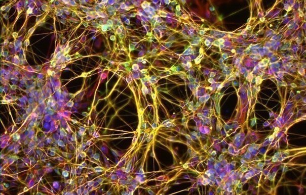 Так выглядят нейроны- нервные клетки человека.