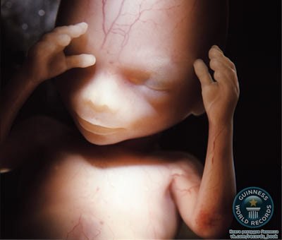 Эмбрион человека, 14 недель размер 20 мм