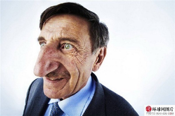61-летний турок Мехмет имеет самый длинный нос в мире длиной 8,8 см.