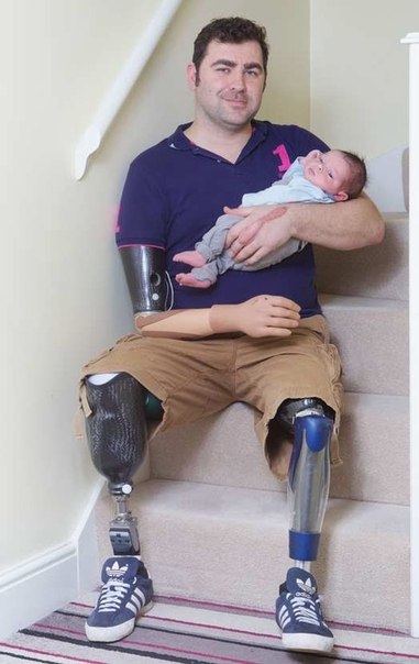 Герой войны, британец Энди Рид (Andy Reid), пятого января 2013 года поделился радостью отцовства, несмотря на потерю трех конечностей.