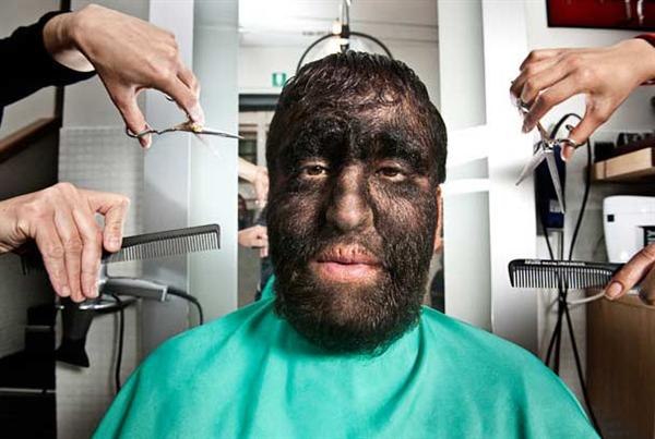 Самым волосатым человеком на земле был признан мексиканец Виктор Гомес. Практически 98% его тела покрыто густым волосяным покровом.