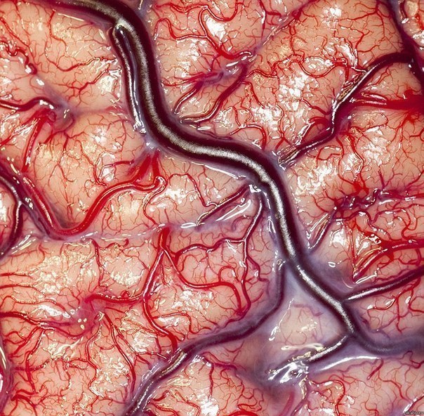 Живой человеческий мозг. 