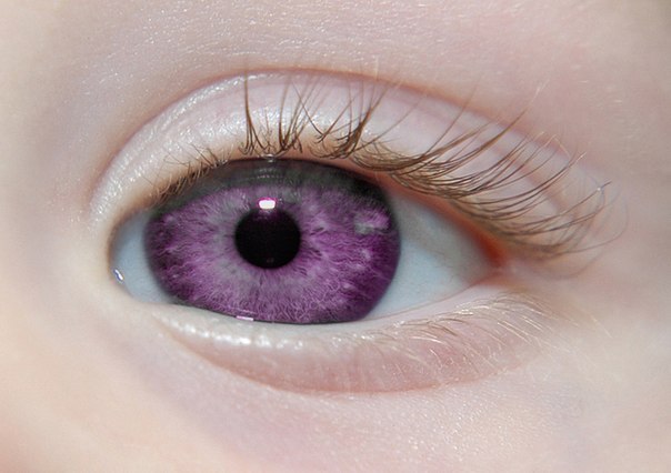 Самый редкий цвет глаз в мире.