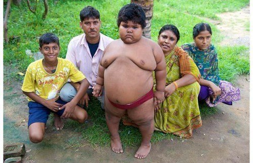 Суман Хатун - самая толстая девочка в мире