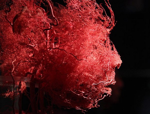 Кровеносные сосуды человеческой головы.