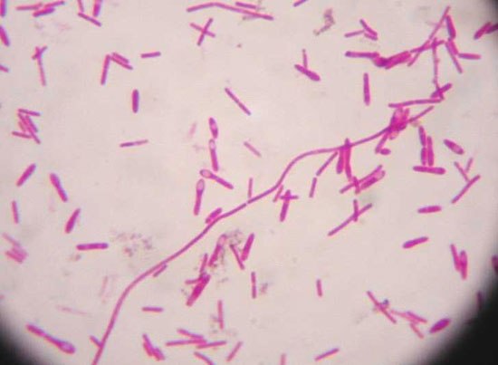 4 кг бактерии Clostridium Botulinum достаточно, чтобы убить всё человечество.