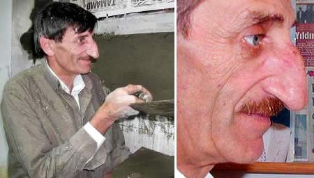 Мехмет Озурек: самый длинный нос в мире